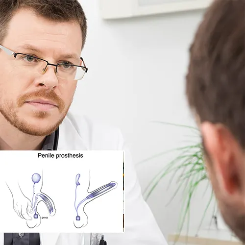 Welcome to  Wauwatosa Surgery Center 
: Exploring Your Options for Penile Implants