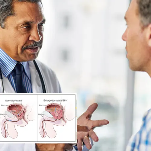 Understanding Penile Implant Longevity and Performance