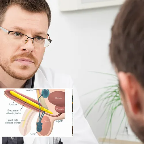 Contact  Wauwatosa Surgery Center 
for Your Penile Implant Surgery Needs