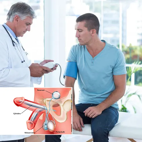 Understanding Penile Implants in Detail